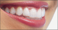How+to+have+healthy+gums+and+teeth